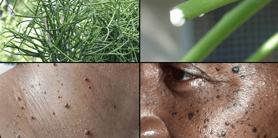 The Pencil Plant FOR WARTS