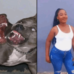 woman attacked by pitbulls