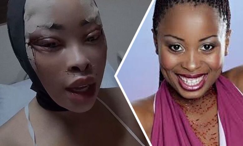 Khanyi Mbau Undergoes Cosmetic Surgery, Buys a "New Face"