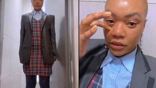 Dress Code Drama: Woman Asked to Leave Work Over "Too Short" Dress, Sparks Debate Online