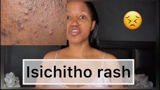 Signs of Isichitho