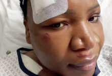 Makhadzi Shares Emotional Recovery Update After Car Accident