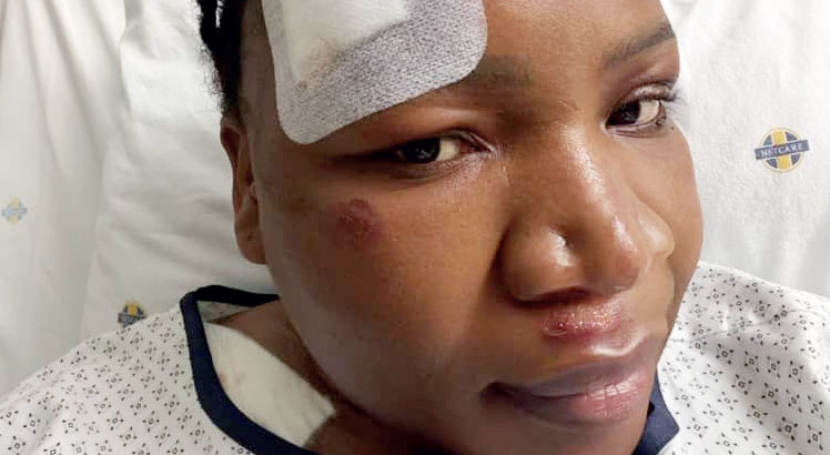 Makhadzi Shares Emotional Recovery Update After Car Accident