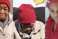 31-Year-Old Woman Opens Up About Rare Ageing Condition